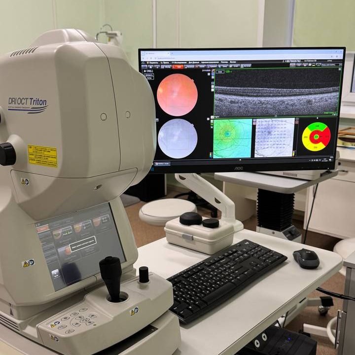 В Костромскую область доставили томограф нового поколения для борьбы с осложнениями диабета